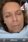 2011-05-15-Janeen's TBI.jpg